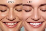 I will retouch skin edit photo professionally in photoshop 12 - kwork.com